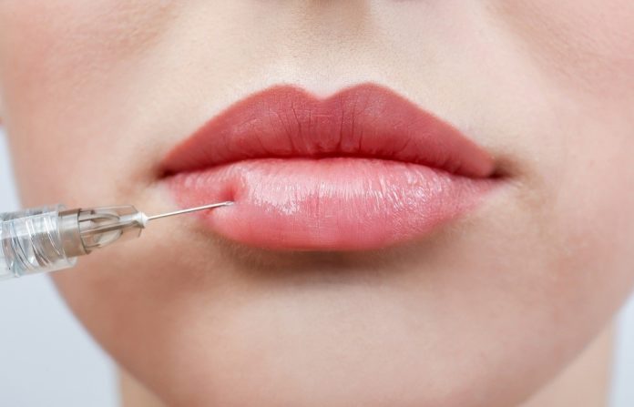 Lip Fillers
